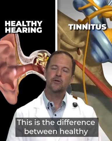 Presentation preview: healthy hearing versus tinnitus